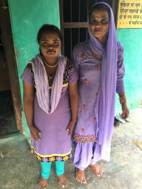 Jyoti, 13 yr. old with Down Syndrome, and her mother, who serves as the Village Resource Person for disabled people